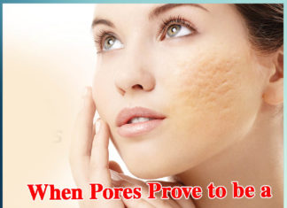 When Pores Prove to be a Hurdle for the Beauty - Sachi Shiksha