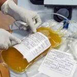 Use of plasma therapy 1