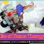 Use of plasma therapy