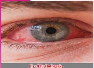 Eye Flu Outbreak -sachi shiksha