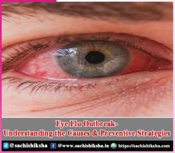 Eye Flu Outbreak -sachi shiksha